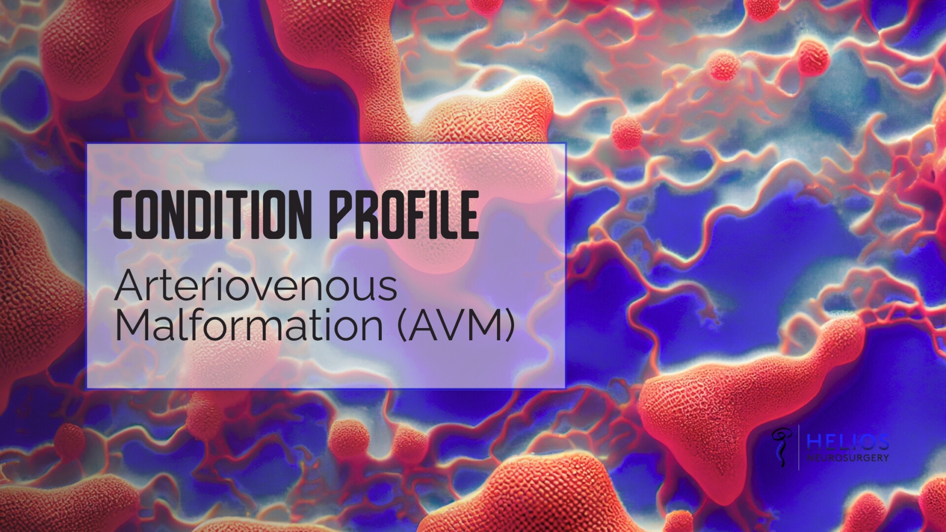 HLN Arteriovenous Malformation (AVM)