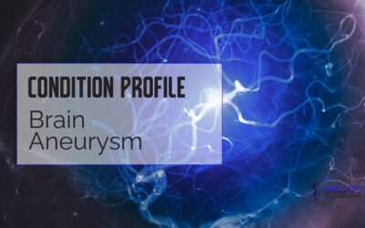 Brain Aneurysm