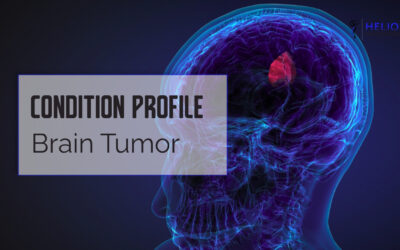 Brain Tumor