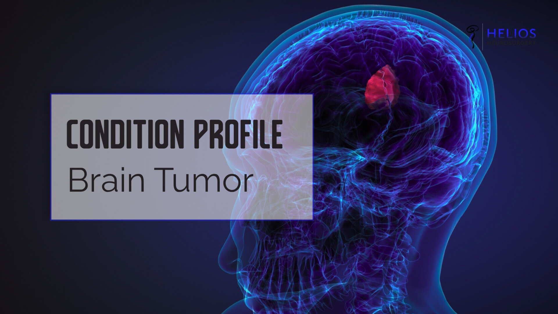 HLN Brain Tumor
