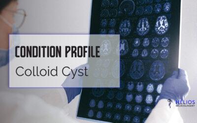 Colloid Cyst
