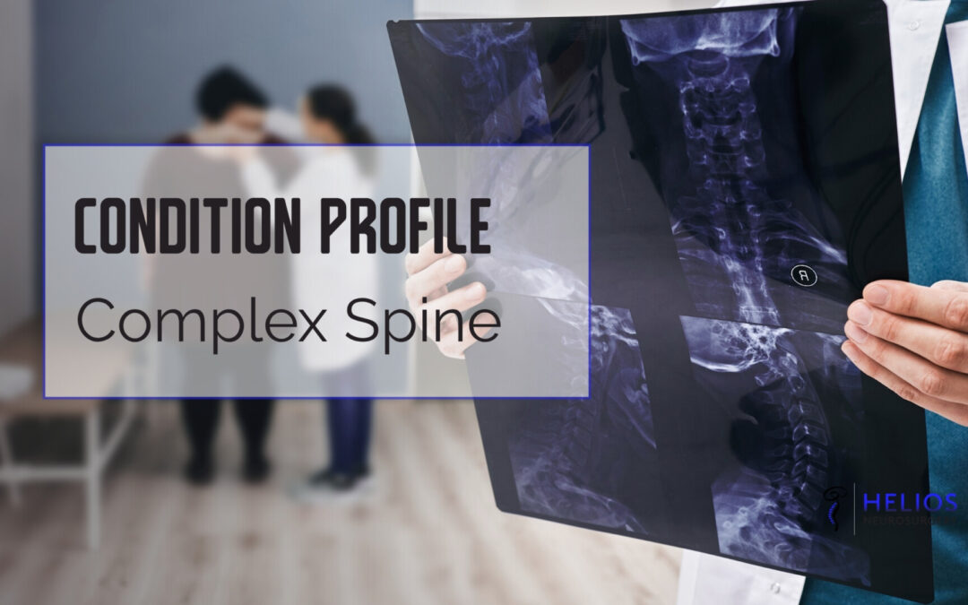 Complex Spine