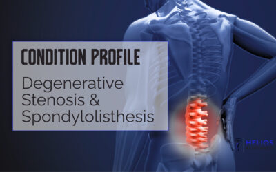 Degenerative Stenosis & Spondylolisthesis