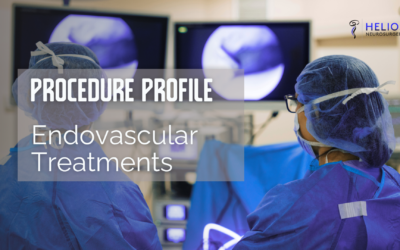 Endovascular Treatments