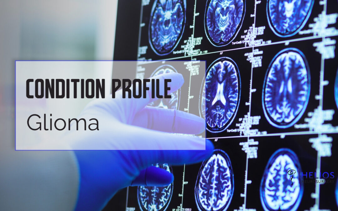Glioma