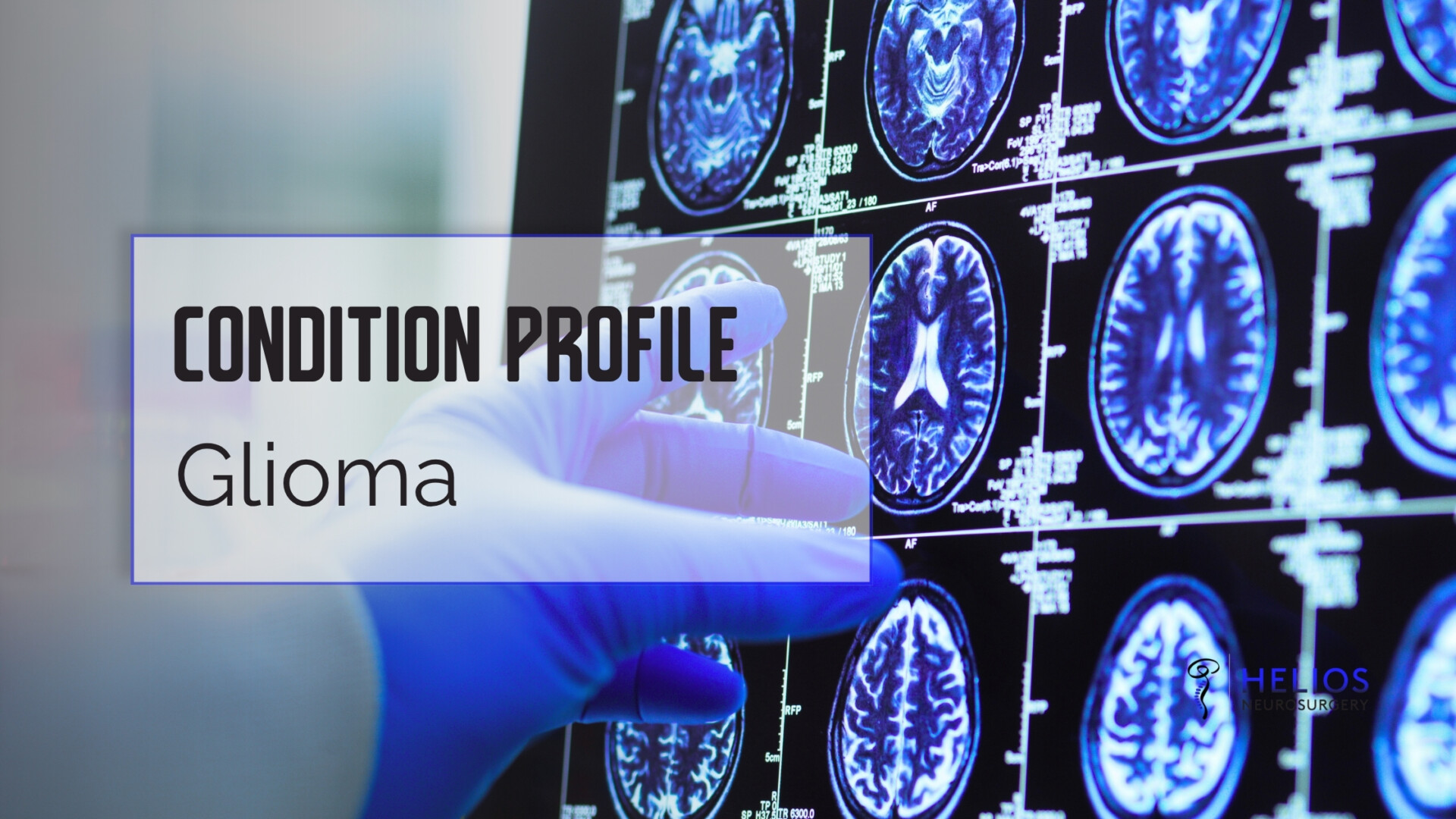 HLN Glioma