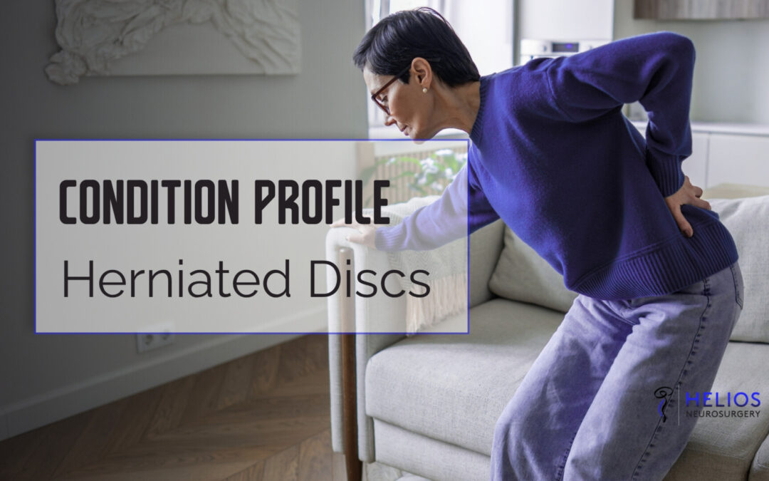 Herniated Discs