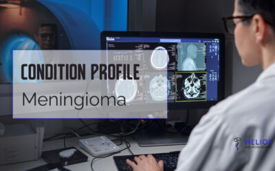 Meningioma