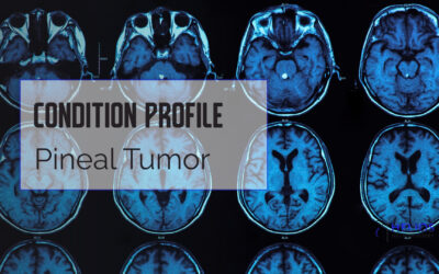 Pineal Tumor