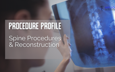 Spine Procedures & Reconstruction