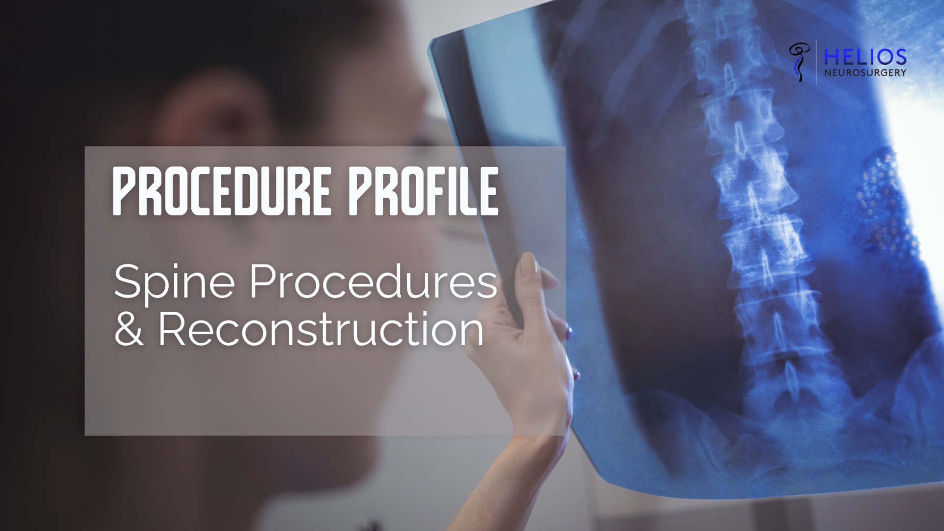 Procedure Profile: Spine Procedures & Reconstruction