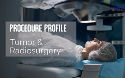 Tumor & Radiosurgery